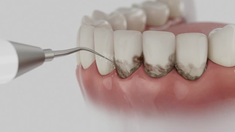 Reliable Tooth Extraction contractor in Odem, TX by Smile Center Dentistry